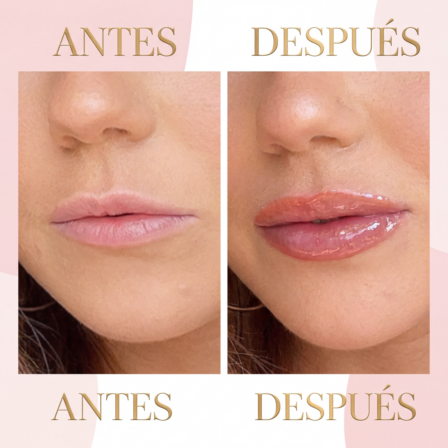 DEROL Lip Volume, voluminizador de labios sin agujas — tercera vista de producto