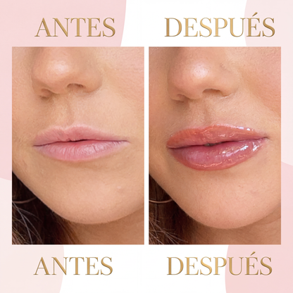 DEROL Lip Volume, voluminizador de labios sin agujas — tercera vista de producto